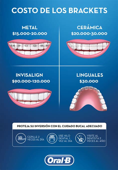 costo de los brackets metalicos en mexico|precio para poner brackets.